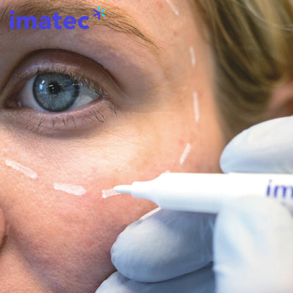 Marktec Skin Markers - White, Green or Red - Boxes of 10